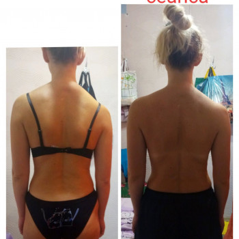 Лечебный глубокомышечный массаж (женщины и дети от 6 лет)/Общий оздоровительный массаж
                    Массажист Ирина Днепр