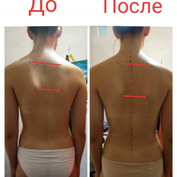 Лечебный глубокомышечный массаж (женщины и дети от 6 лет)/Общий оздоровительный массаж
                    Массажист Ирина Днепр