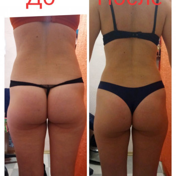 Антицелюлітний масаж. Корекція фігури. Магістральний лімфодренаж / Антицеллюлитный массаж. Коррекция фигуры. Магистральный лимфодренаж
                    Массажист Ирина Днепр