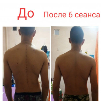 Лікувальний масаж та ЛФК для дітей і дорослих при порушенні постави / Лечебный массаж и ЛФК  для детей и взрослых при нарушении осанки
                    Массажист Ирина Днепр