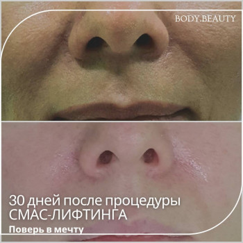 Сергій Савін, Запоріжжя Фото - 11