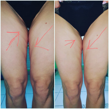 Сергій Савін, Запоріжжя Фото - 4