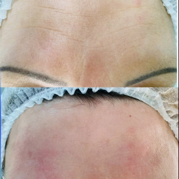 Сергій Савін, Запоріжжя Фото - 7