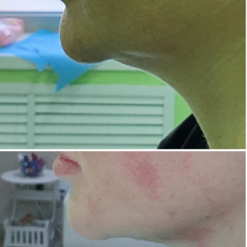 Сергій Савін, Запоріжжя Фото - 2