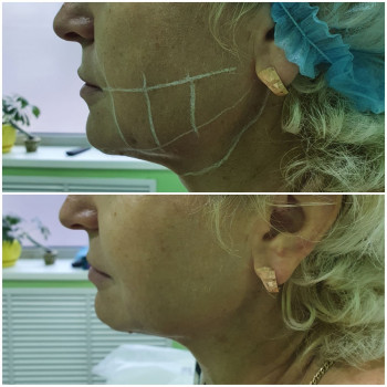 Сергій Савін, Запоріжжя Фото - 10