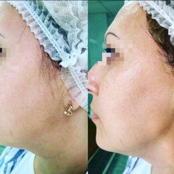 Сергій Савін, Запоріжжя Фото - 16