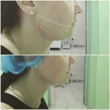 Сергій Савін, Запоріжжя Фото - 18