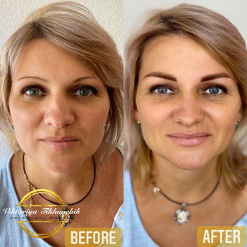 Виктория Тихончик, Николаев Фото - 8