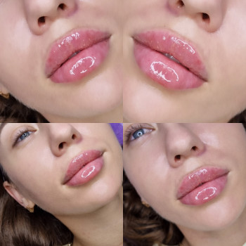 Елена Журба, Кропивницкий Фото - 3