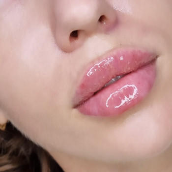 Елена Журба, Кропивницкий Фото - 5