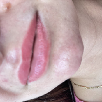 Заживший пм губ