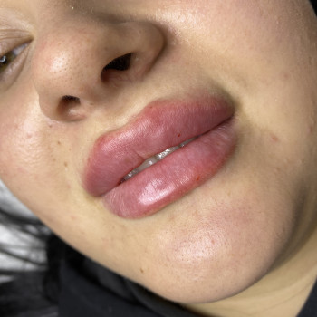 Фото из портфолио косметолога Ирина Зеленина (Павлоград)