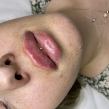 Фото из портфолио косметолога Ирина Зеленина (Павлоград)