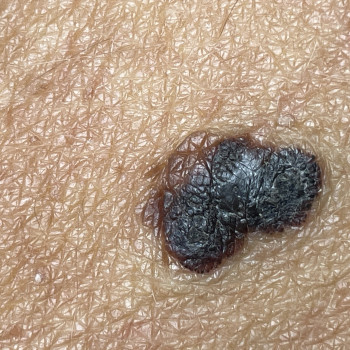 Вікторія Хрущ, Одеса Фото - 5