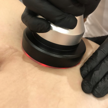 IceBeauty, Луцк Фото - 6