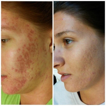 Файно Охайно, Київ Фото - 34