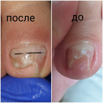 Людмила Виржанская, Киев Фото - 9