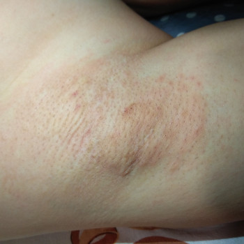 Наталія Мозгова, Одеса Фото - 6