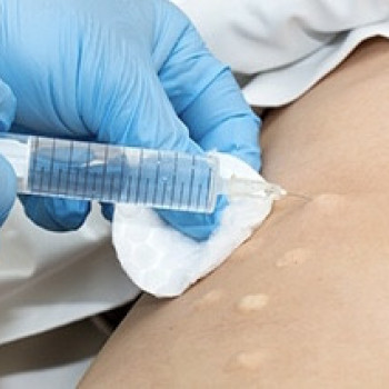 Для обработки участков тела с расстяжками, стриями,рубцами и