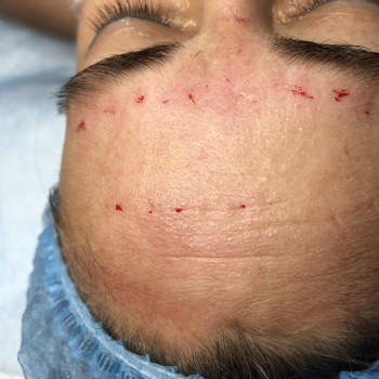 Работа с морщинами и заломами!