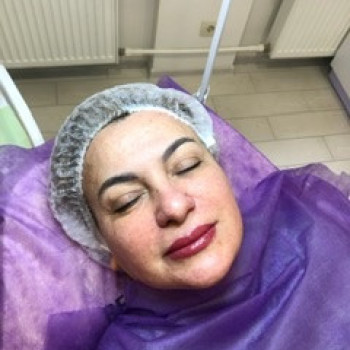 Ольга Редчиць, Чернігів Фото - 63