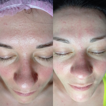 Марина Щегловская, Никополь Фото - 18