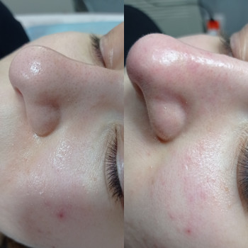 Марина Щегловская, Никополь Фото - 19