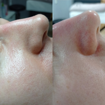 Марина Щегловская, Никополь Фото - 22