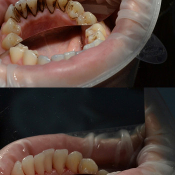 Аліна Степанюк, Рівне Фото - 6