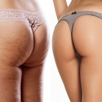 Виктория Бершадская, Киев Фото - 6