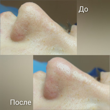 Кристина Лопатина, Одесса Фото - 13