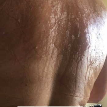 Обёртывание CelloGel
                    СПА-салон GARNA Мариуполь