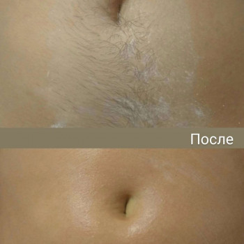 Диана Тесленко, Біла Церква Фото - 10