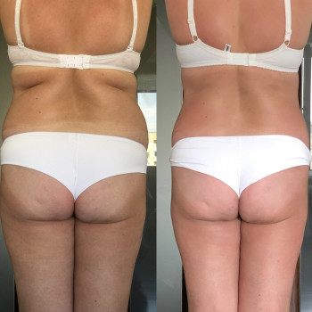 Наталія Пасько, Одеса Фото - 6