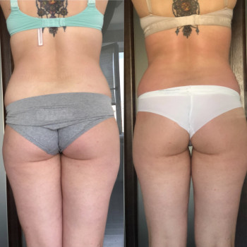 Наталія Пасько, Одеса Фото - 7