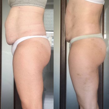 Наталія Пасько, Одеса Фото - 8