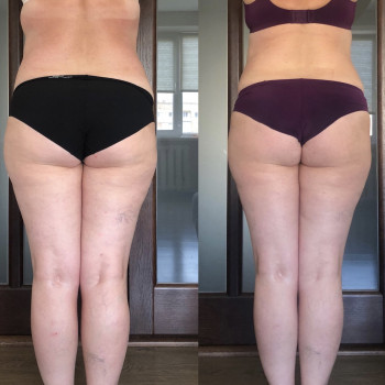 Наталія Пасько, Одеса Фото - 3