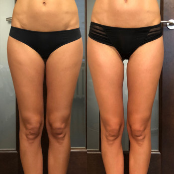 Наталія Пасько, Одеса Фото - 11