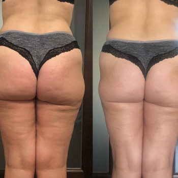 Наталія Пасько, Одеса Фото - 12