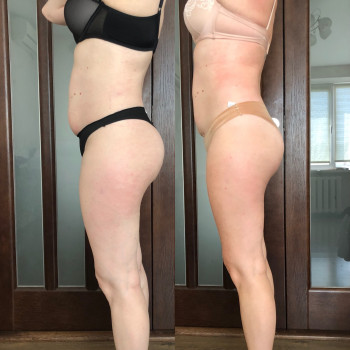 Наталія Пасько, Одеса Фото - 13