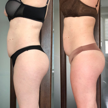 Наталія Пасько, Одеса Фото - 15