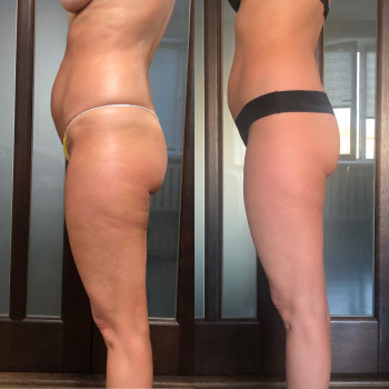 Наталія Пасько, Одеса Фото - 16