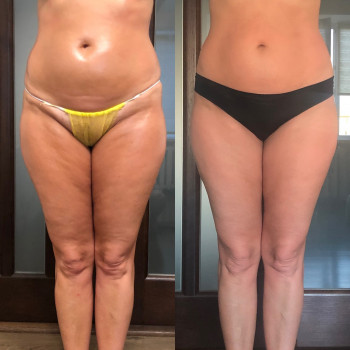 Наталія Пасько, Одеса Фото - 17