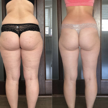 Наталія Пасько, Одеса Фото - 19