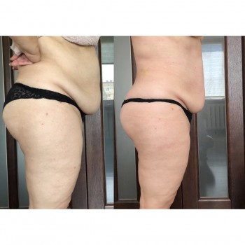 Наталія Пасько, Одеса Фото - 20