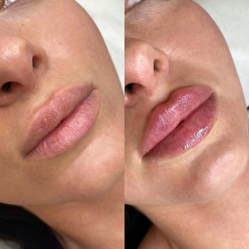 Светлана Василенко, Харьков Фото - 4