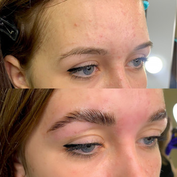 Ламинирование бровей
                    Косметолог-инъекционист Екатерина Харьков