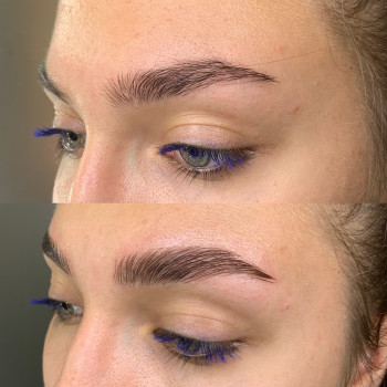 Ламинирование бровей
                    Косметолог-инъекционист Екатерина Харьков