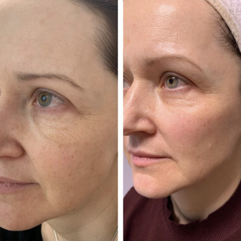 Христина Антонова, Київ Фото - 6