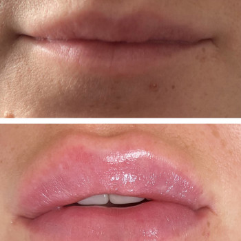 Христина Антонова, Київ Фото - 7